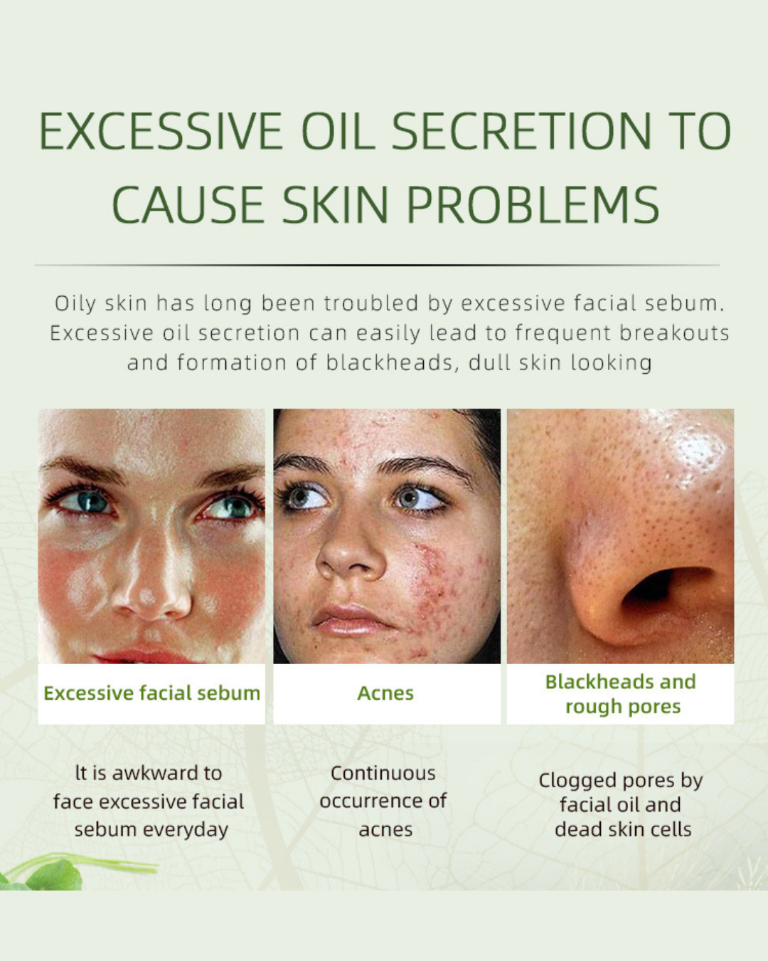 Herbal Anti-Acne Brightening Care Cream