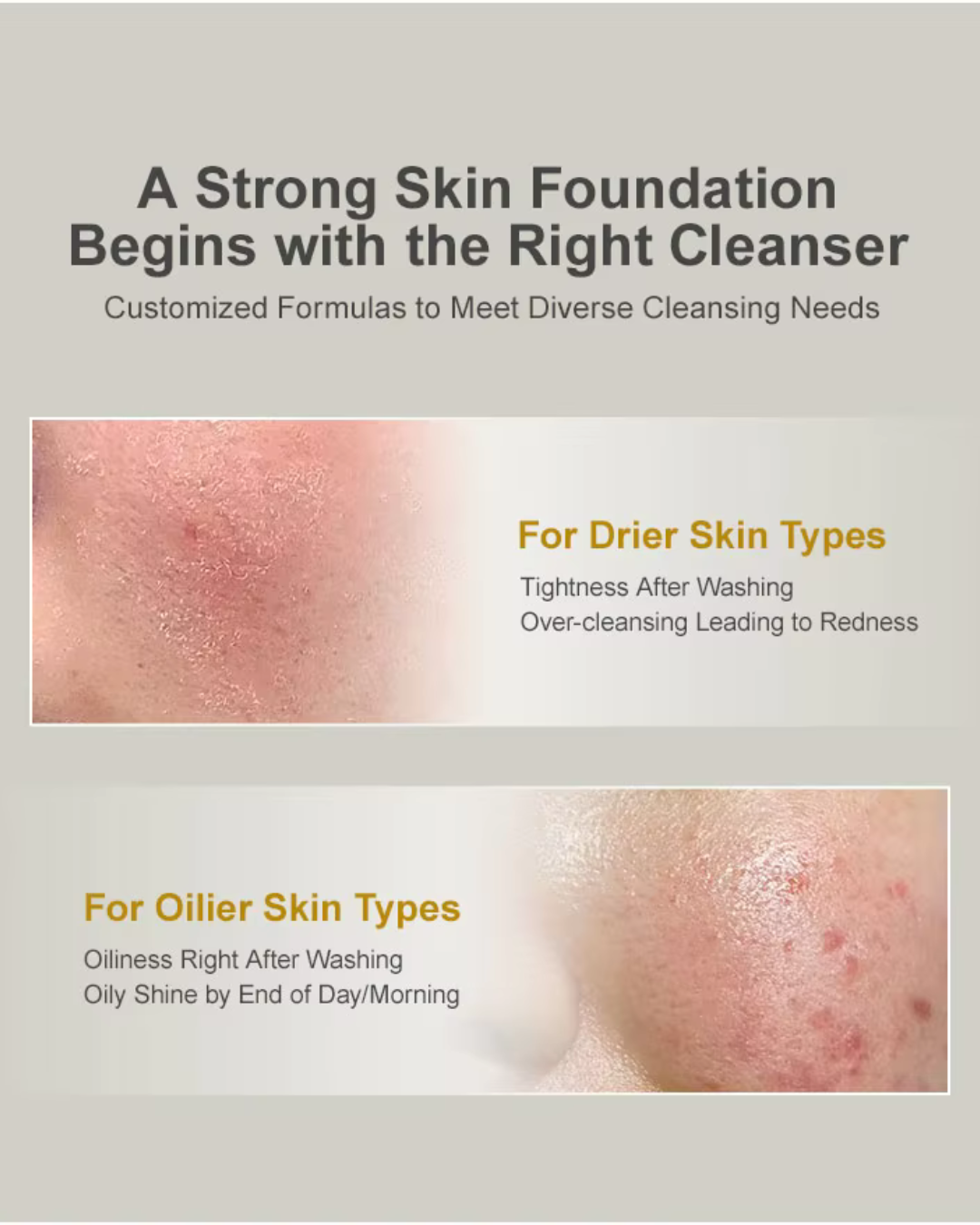 Amino Acid Cleansing Mousse