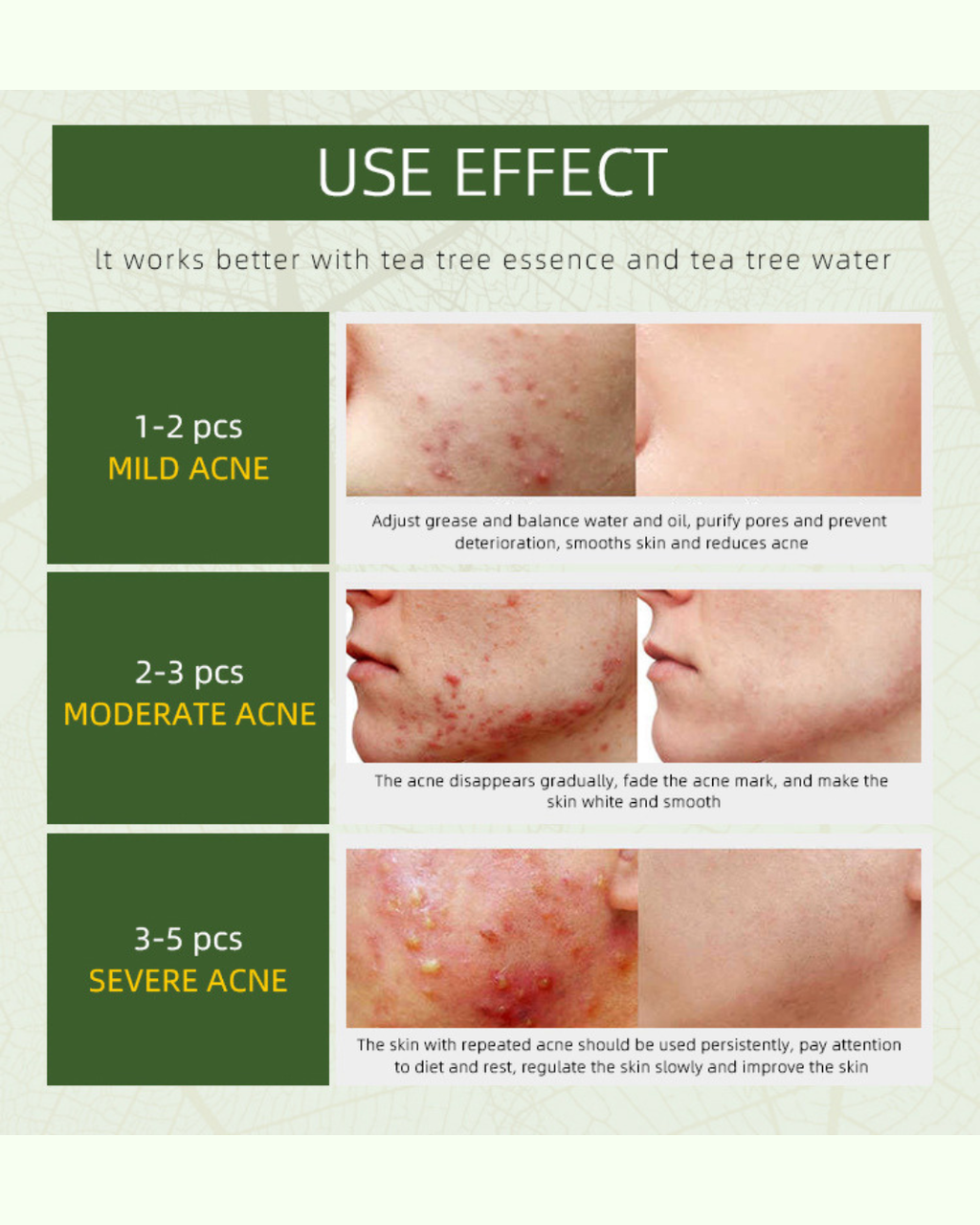 Herbal Anti-Acne Brightening Care Cream